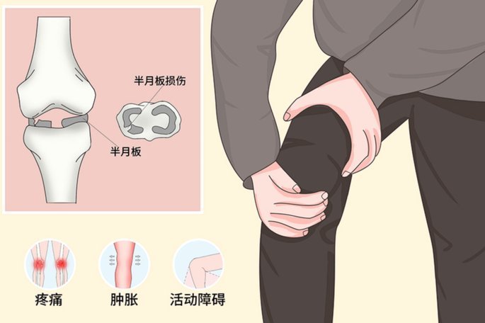 高迪半月板受伤 预计四周恢复